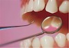 خدمات دندان پزشکی غیرضروری را به تعویق بیندازید