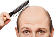 با این ۷ ماده غذایی به کابوس ریزش مو پایان دهید