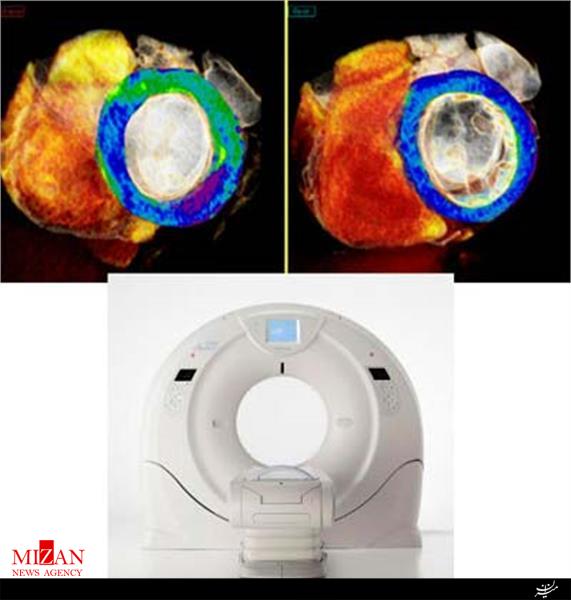 موفقیت پزشکان ایرانی در علم تصویربرداری قلب