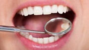 ۵ درمان خانگی برای پوسیدگی دندان‌
