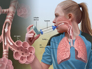 درمان آسم و تنگی نفس |روش های مقابله و درمان آسم