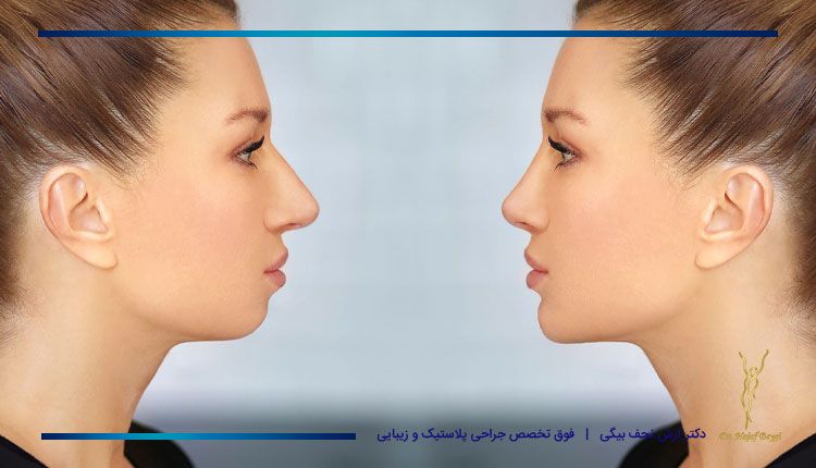 بی عارضه ترین روش ها برای لاغر کردن صورت