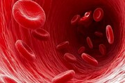 سرطان خون |  درمان جدید سرطان خون