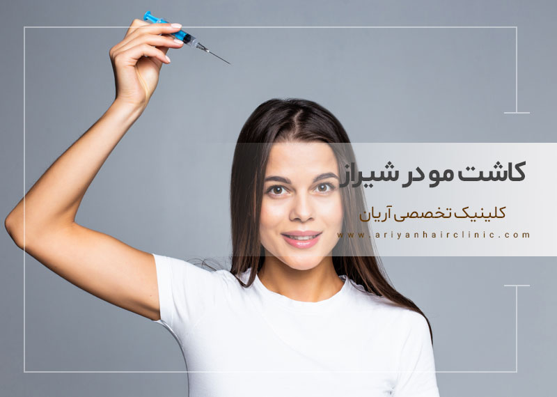 با بهترین مرکز کاشت مو در شیراز آشنا شوید