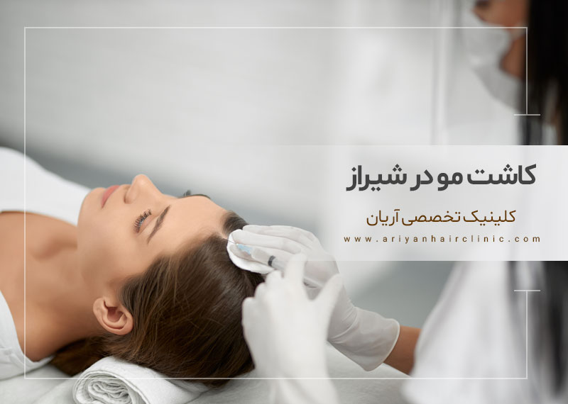 با بهترین مرکز کاشت مو در شیراز آشنا شوید