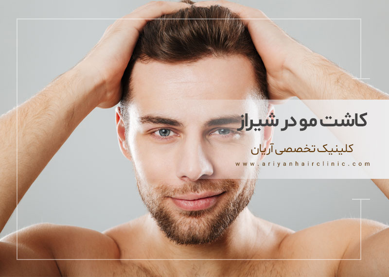 با بهترین مرکز کاشت مو در شیراز آشنا شوید