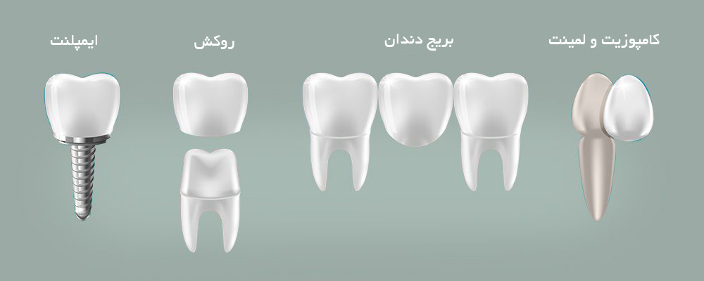 بررسی فرق بریج و کامپوزیت