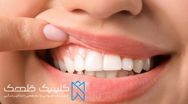 اقدامات قبل از ارتودنسی دندان چیست؟