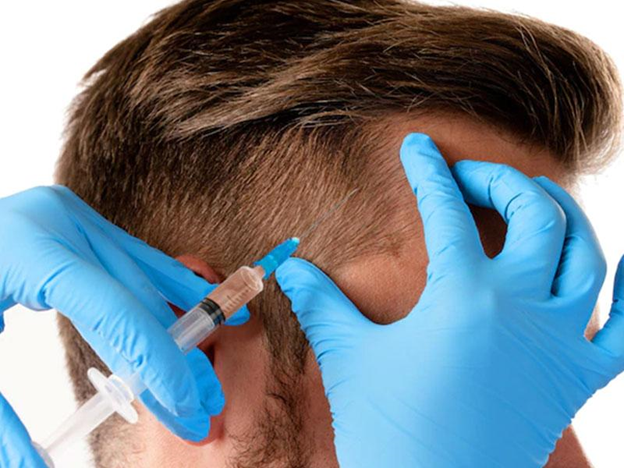 مزوتراپی مو چیست؟ مزایا و معایب این روش 