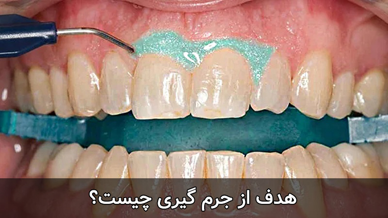 هدف از جرم گیری چیست