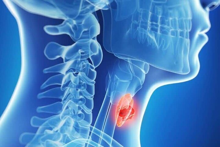 غذاهای مفید برای کنترل تیروئید