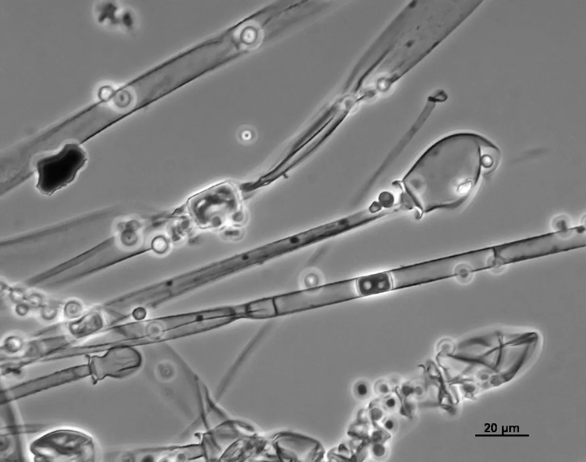 قارچ رودهای Mucor racemosus (موکور راسموسوس)