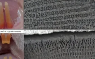 دود سیگار، رقیب نهان مینای دندان در نوزادان