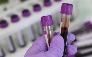تشخیص خطر ابتلا به اختلالات کاردیومتابولیک در کودکان از طریق آزمایش خون