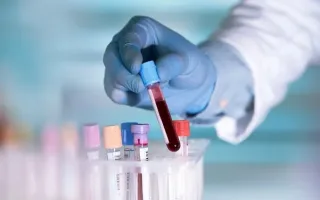 خطر عفونت HPV به شدت جدی است؛ دغدغه یک ویروس‌شناس