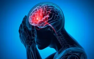 استفاده از هوش مصنوعی برای پیش‌بینی ریسک سکته مغزی / مدل نوآورانه‌ای که تخمینی دقیق‌تر از خطرات ژنتیکی را ارائه می‌دهد