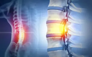 پیشرفت قابل توجه در علم پزشکی؛ نخستین پیوند نخاع انسان در روسیه